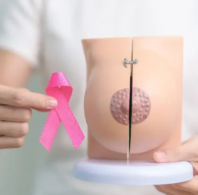 cáncer de mama en mujeres